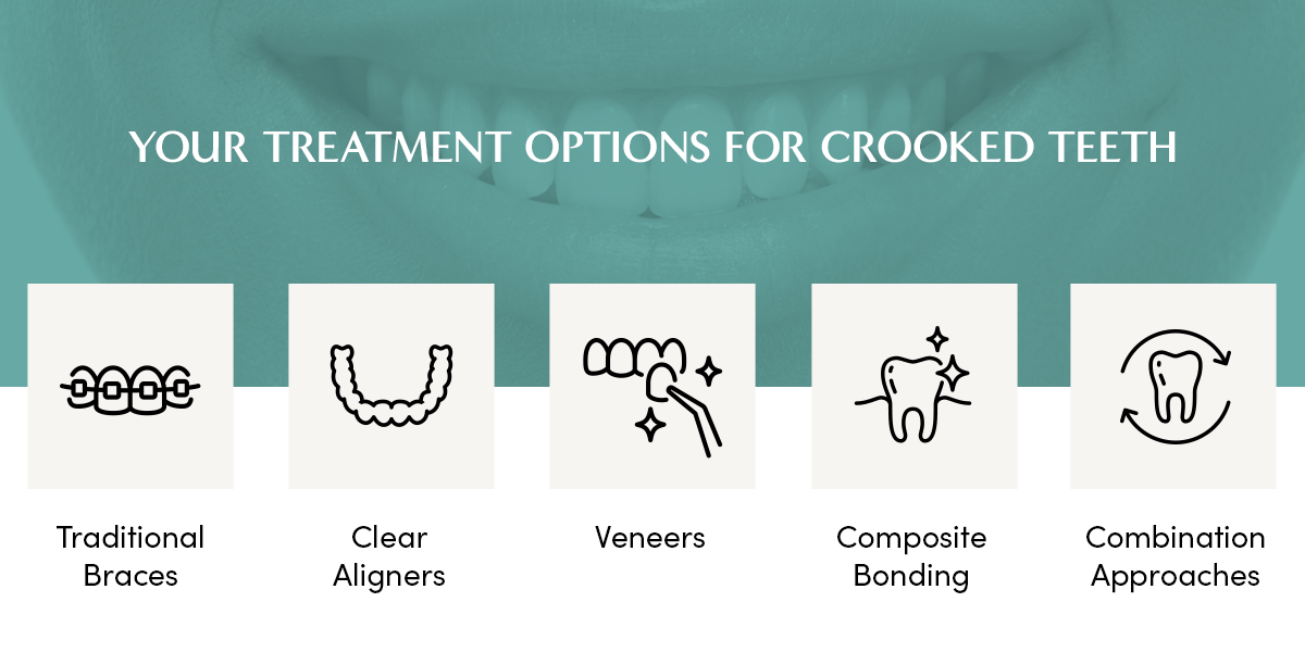 Your Treatment Options for Crooked Teeth