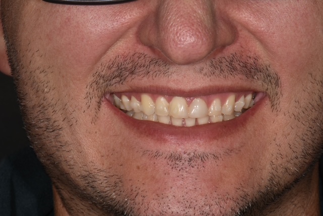 Before